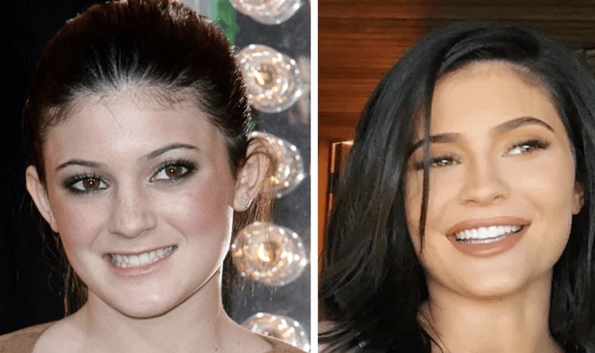 Kendall Jenner Teeth kapak