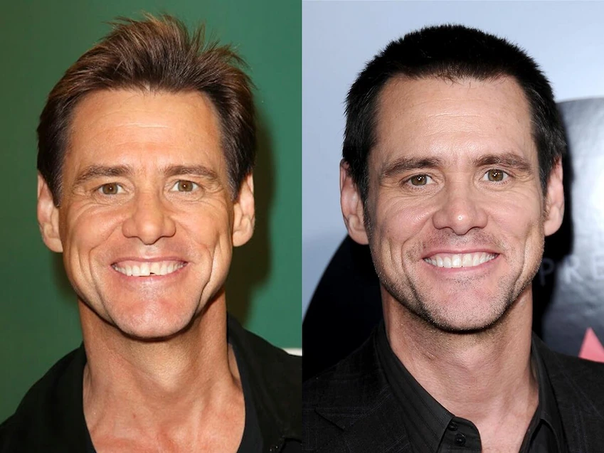 jim carry before after