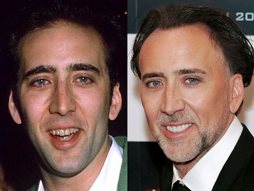 nicolas cage teeth kapak