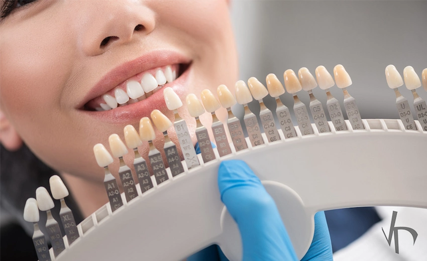 dental ceramic crowns