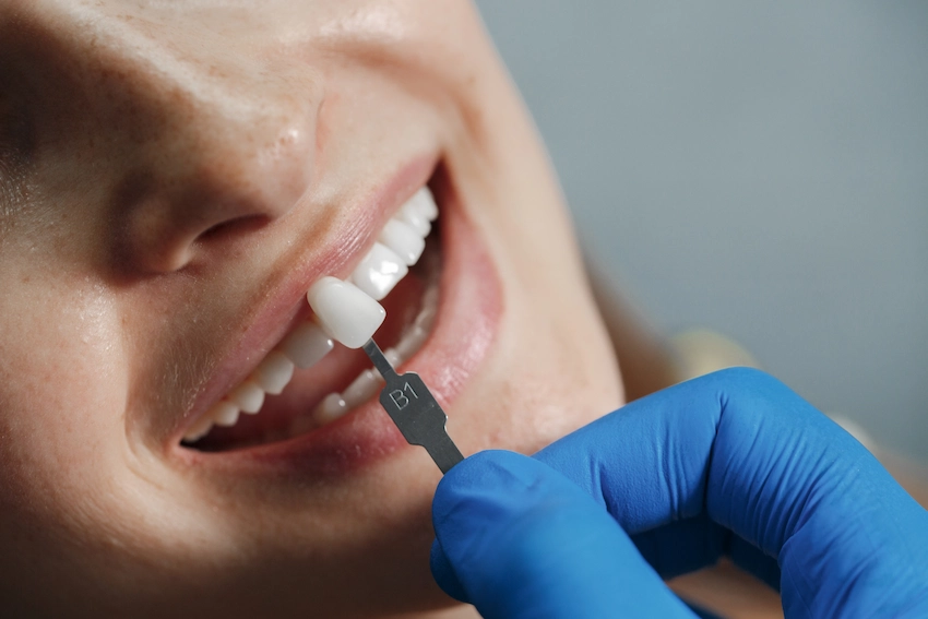 best destinations for dental implants