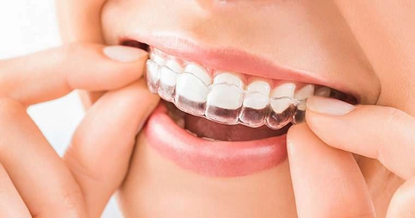 best night guards for tmj