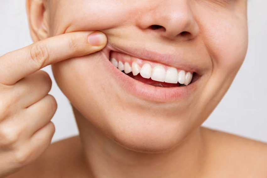 causes and treatments for white gums