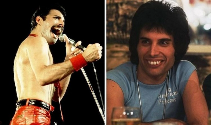 freddie mercurys teeth an iconic smile