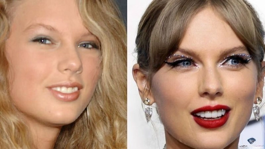 taylor swift teeth natural or veneers