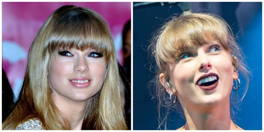 taylor swift teeth