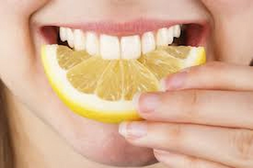 teeth whitening