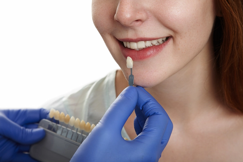 tooth crown surgery what to expect