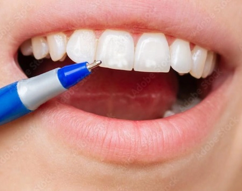 white spots causes
