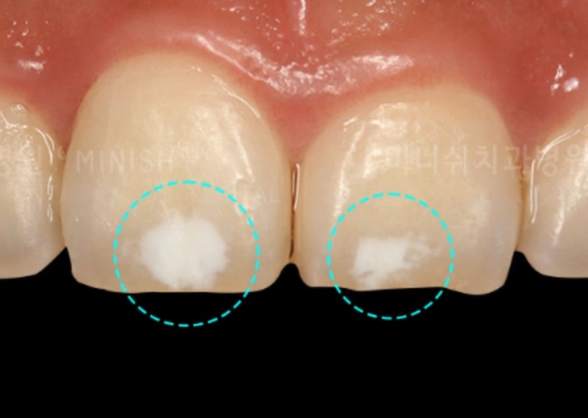 white spots
