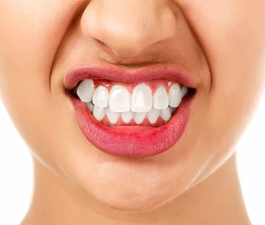 bruxism treatment