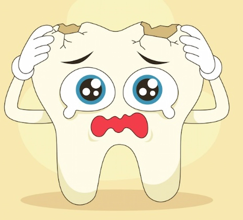 cracked tooth syndrome