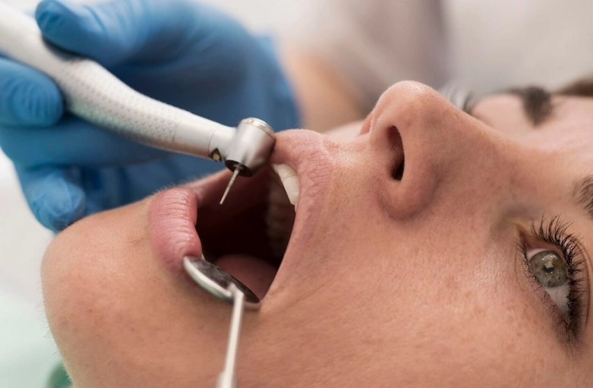 dental filling process