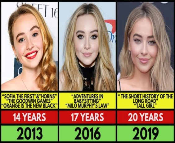 sabrina-carpenter-new-teeth-new-dental-1