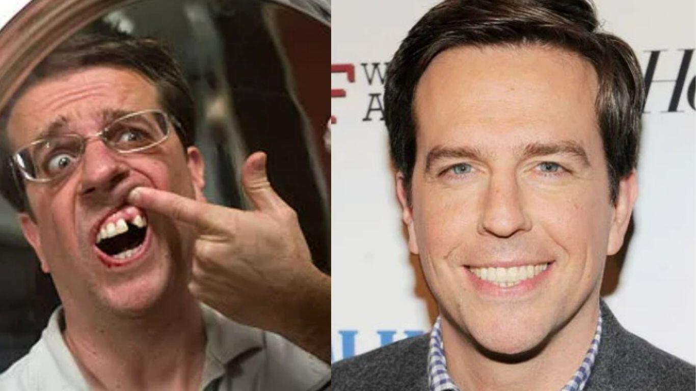 ed helms teeth before after