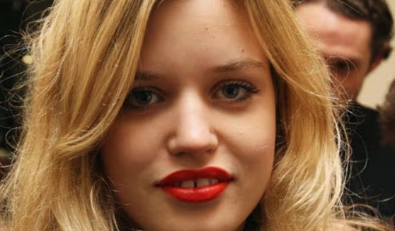 georgia may jagger teeth in 2010