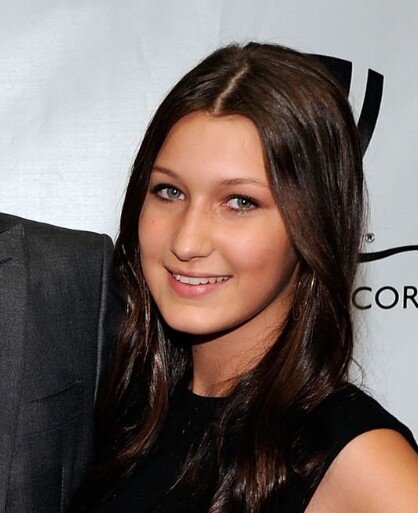 bella hadid teeth in 2010