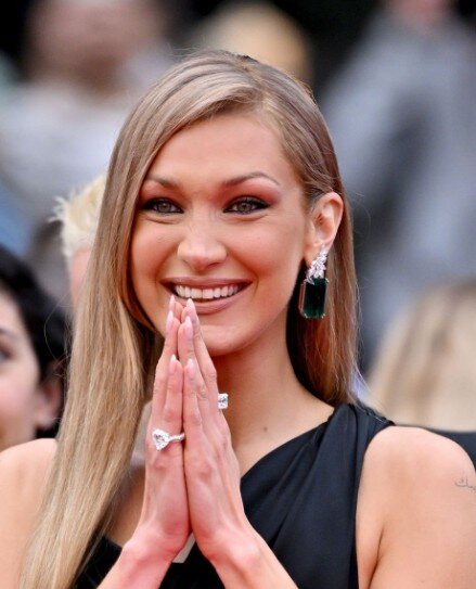 bella hadid teeth in 2025