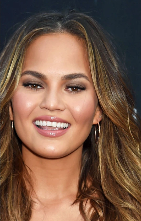 chrissy teigen teeth in 2009