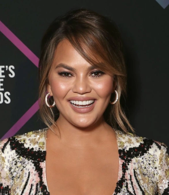 chrissy teigen teeth in 2018