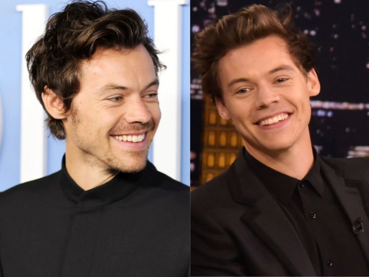 harry styles teeth before after