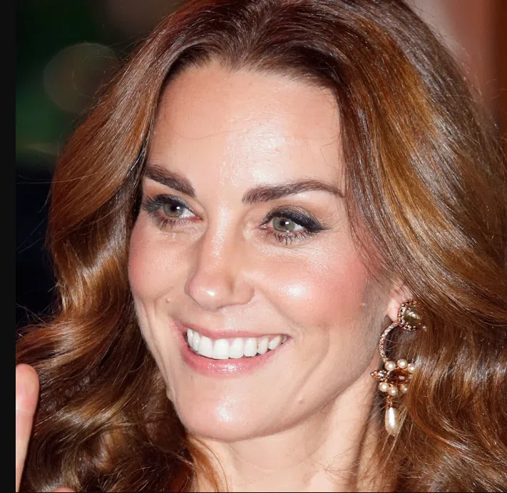 kate middleton teeth in 2025