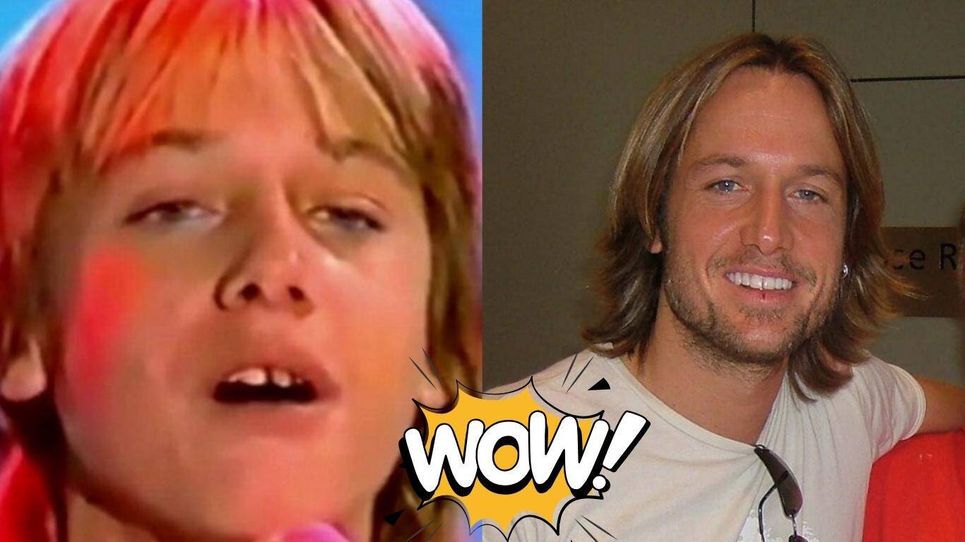 keith urban teeth before after
