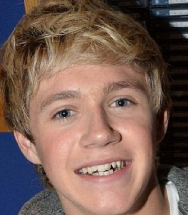 niall horan teeth in 2007