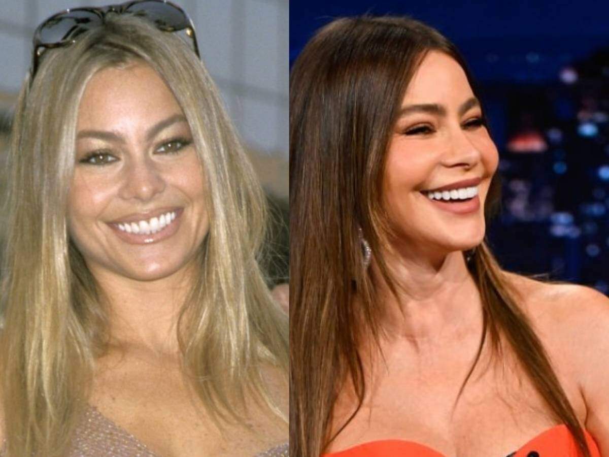 sofia vergara teeth before after