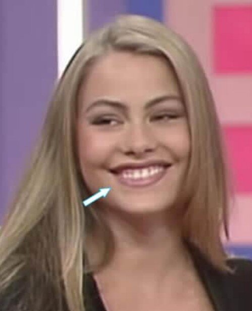 sofia vergara teeth in 1993