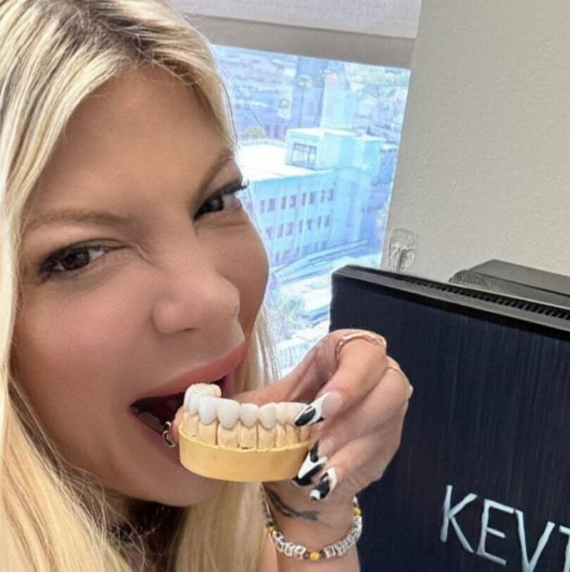 tori spelling teeth