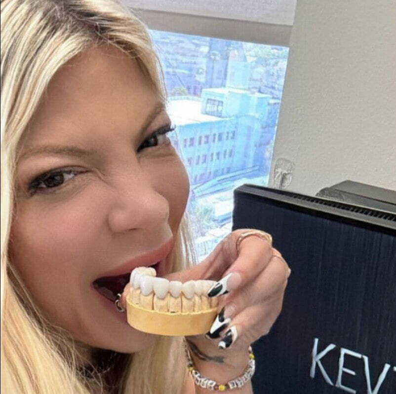 tori spelling teeth in 2024