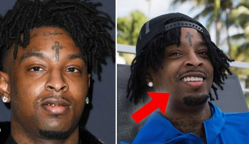 21 savage teeth