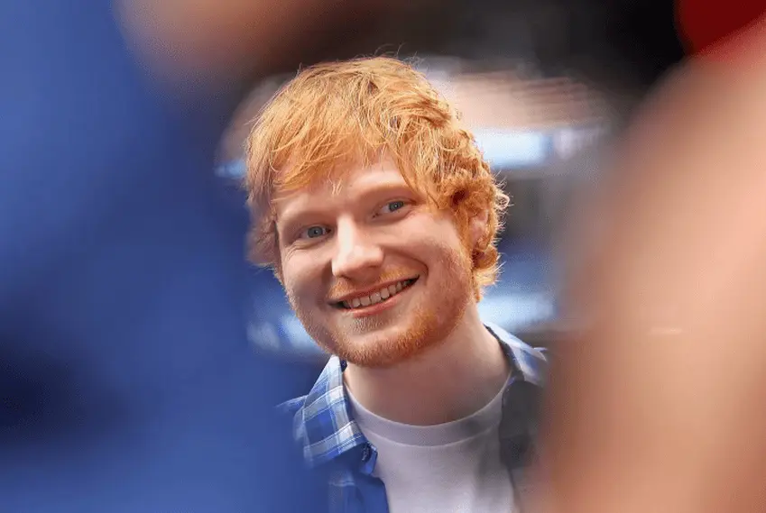 Ed sheeran teeth transformation