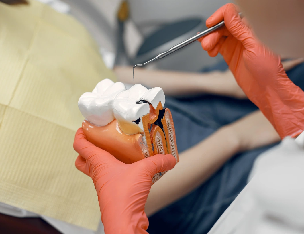 How Much Is a Root Canal Treatment