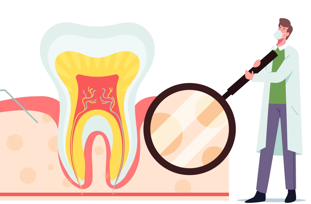 How to Tell If You Need a Root Canal
