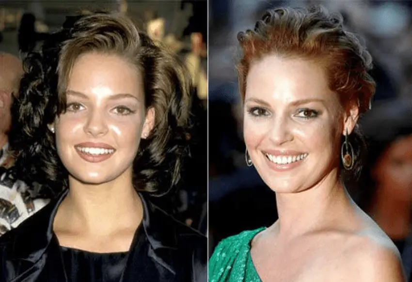 Katherine heigl teeth transformation