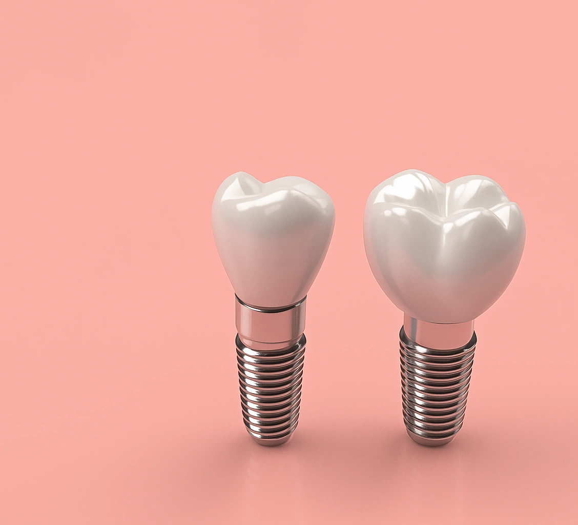 What Are Mini Dental Implants