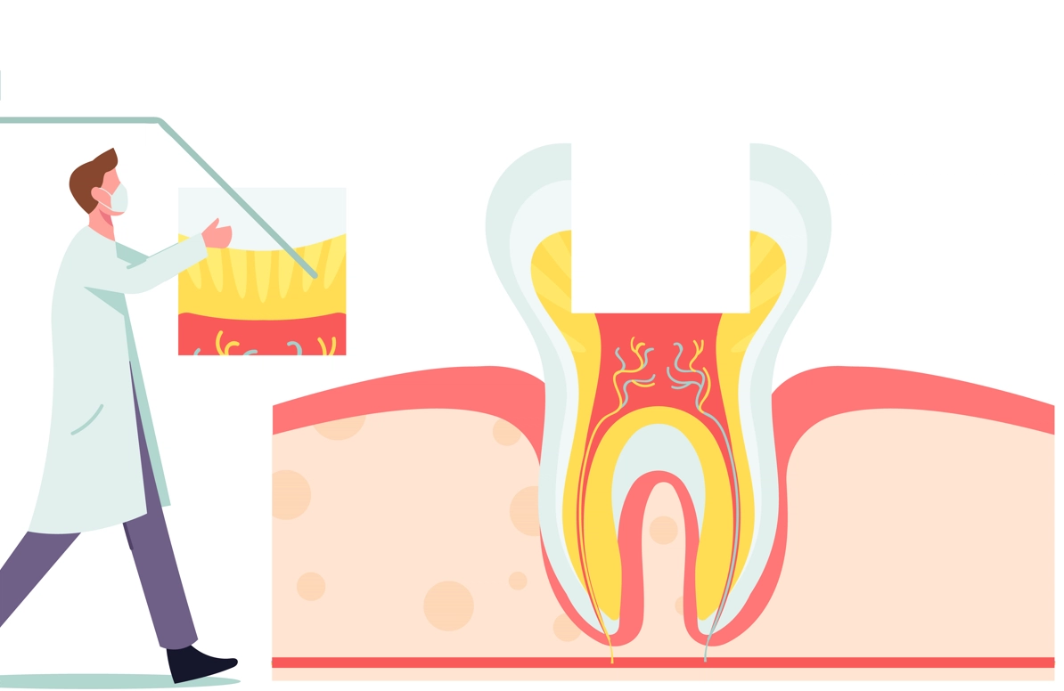What is a Root Canal Treatment