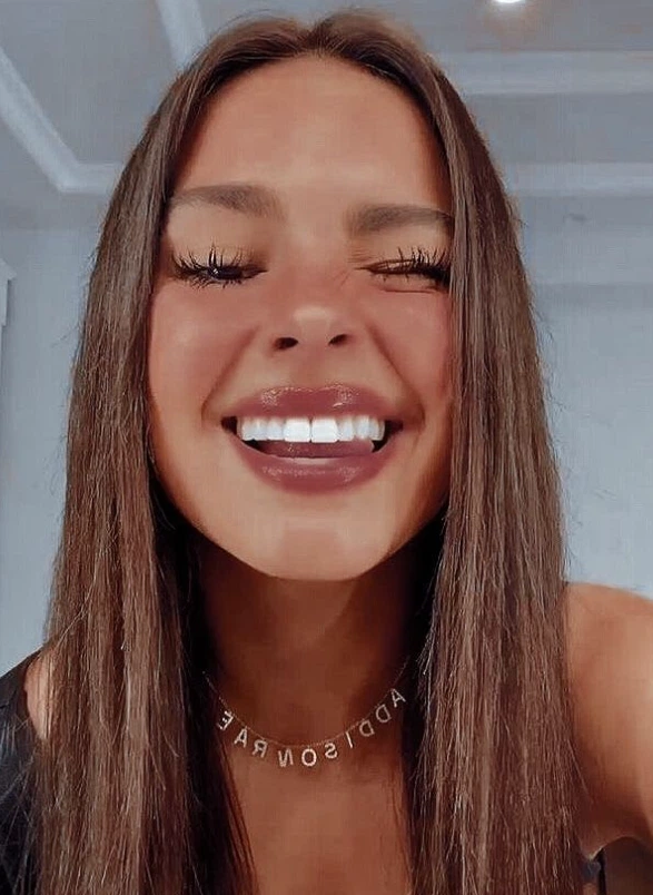зъбите на Addison Rae през 2025