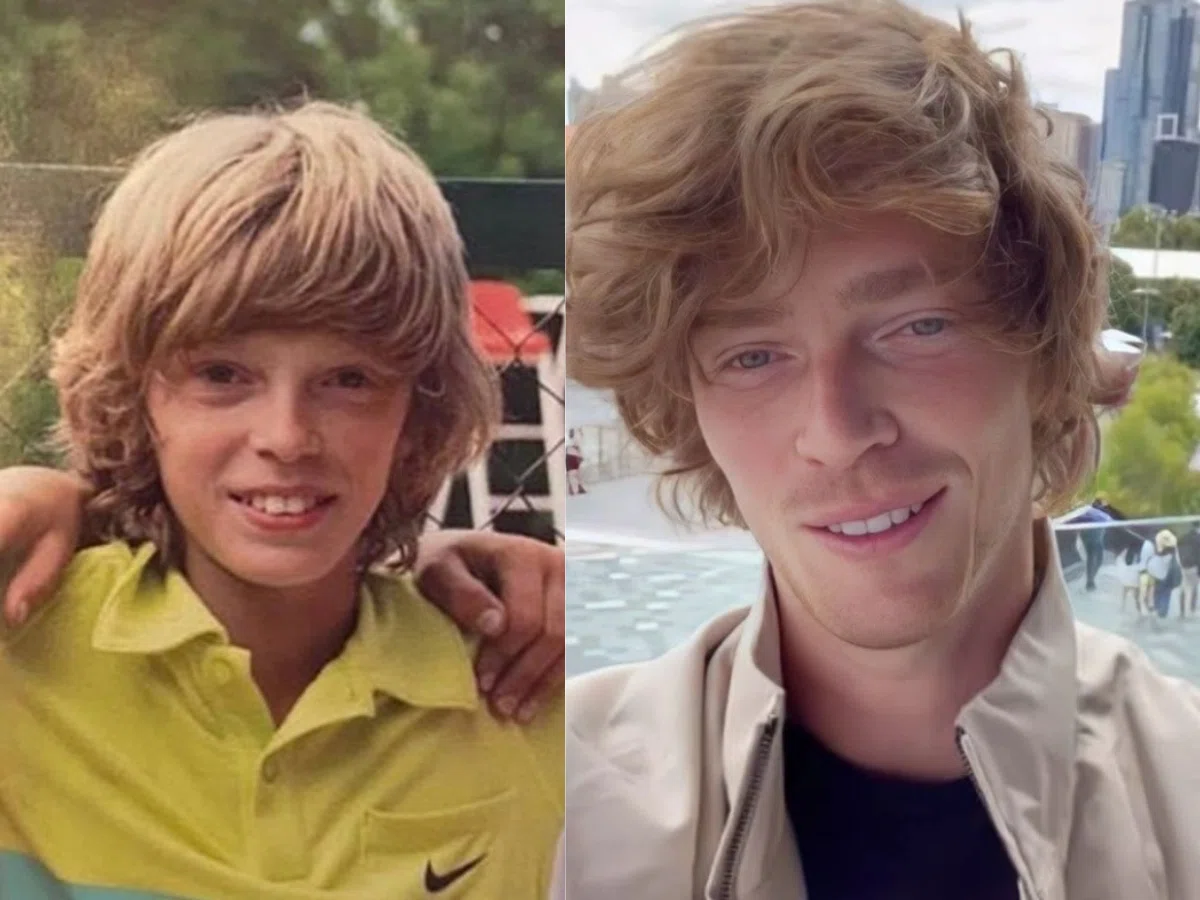 andrey rublev teeth before after