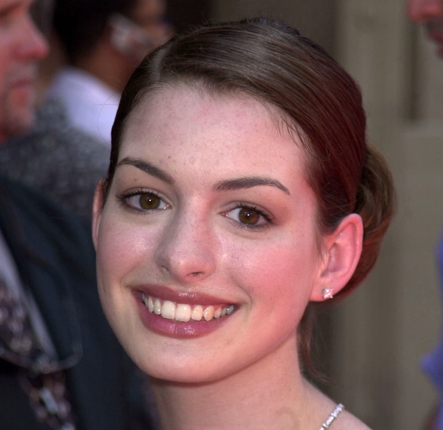 Anne Hathaway teeth in 2001