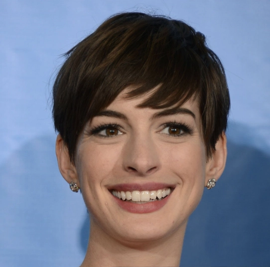 Anne Hathaway teeth in 2013