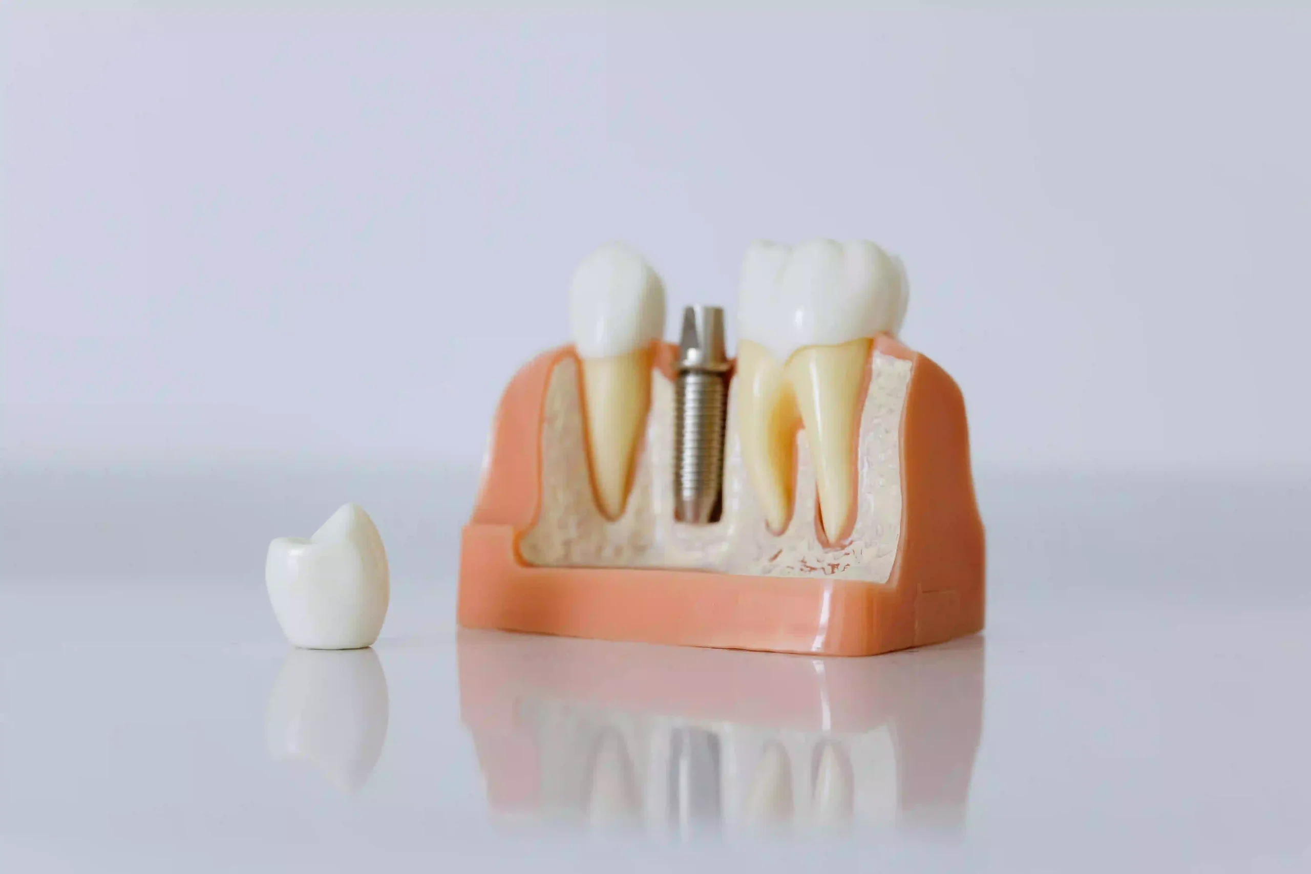 are Medentika dental implants dental products strong safe