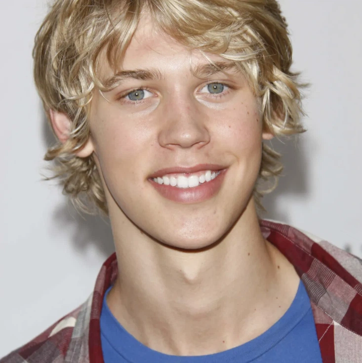 austin butler teeth in 2010