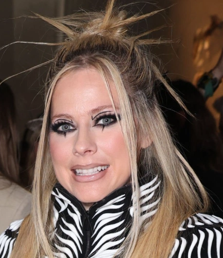 avril lavigne teeth in 2025