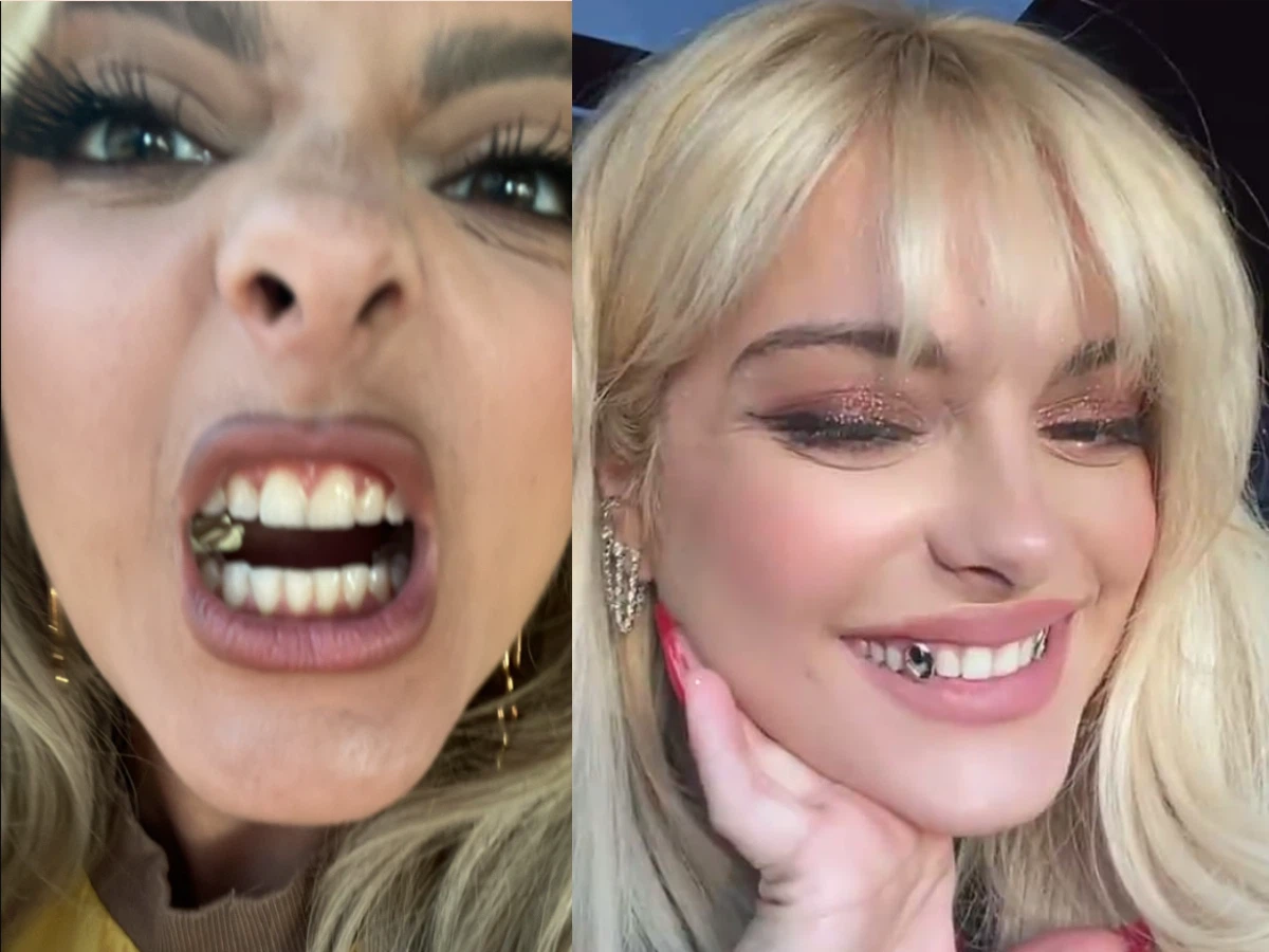 bebe rexha teeth