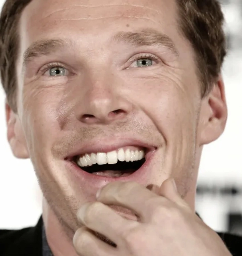 benedict cumberbatch teeth