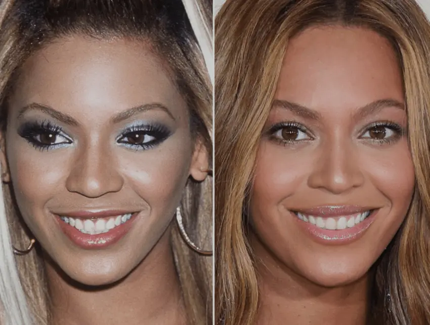 beyonce teeth transformatioon