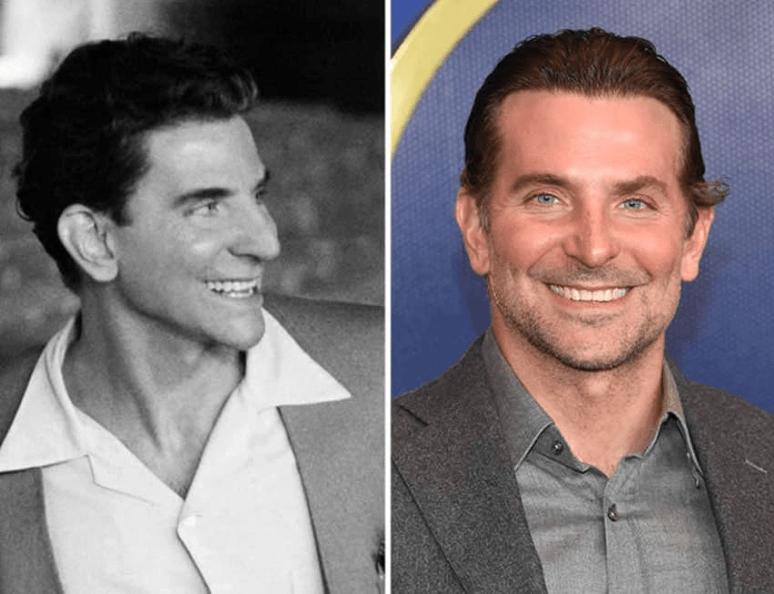 bradley cooper teeth
